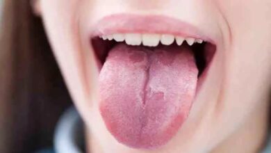 Photo of Qué significa tener la lengua blanca y las formas para solucionarlo