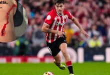 Photo of La impactante herida que sufrió un jugador del Bilbao en las semifinales ante el Manchester United