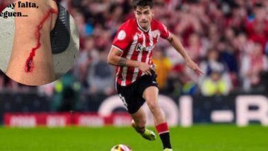 Photo of La impactante herida que sufrió un jugador del Bilbao en las semifinales ante el Manchester United