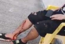 Photo of Otra vez la violencia en Brasil: un hincha de Colo Colo herido de bala