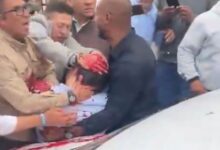 Photo of El senador Miguel Uribe Turbay fue operado con éxito tras ser baleado en un acto en Bogotá