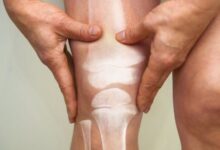 Photo of Los 6 antiinflamatorios naturales que se pueden usar para terminar con el dolor de rodilla