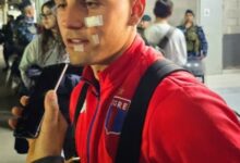 Photo of Cómo le quedó la cara a Nacho Russo tras los cortes sufridos en Tigre vs. San Lorenzo por Copa Argentina