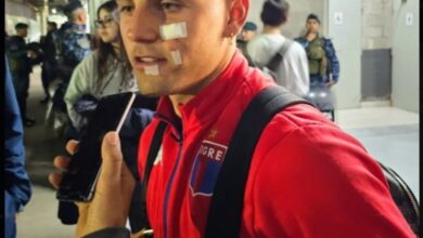 Photo of Cómo le quedó la cara a Nacho Russo tras los cortes sufridos en Tigre vs. San Lorenzo por Copa Argentina